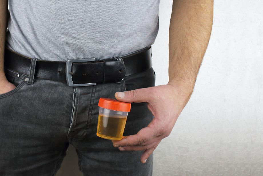 Pourquoi mon urine sent fort ? Causes et solutions à long terme